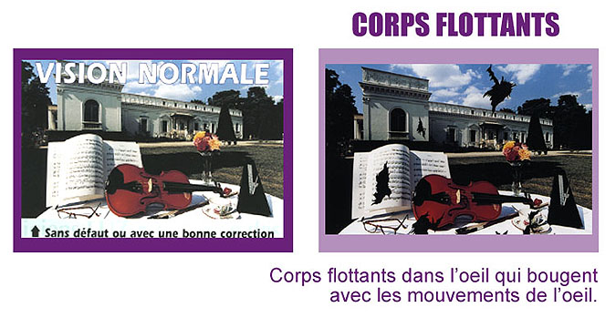 vision corps flottants